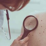 “Salvá tu piel”: Campaña gratuita para prevenir el cáncer de piel llega este fin de semana a Tres Cruces