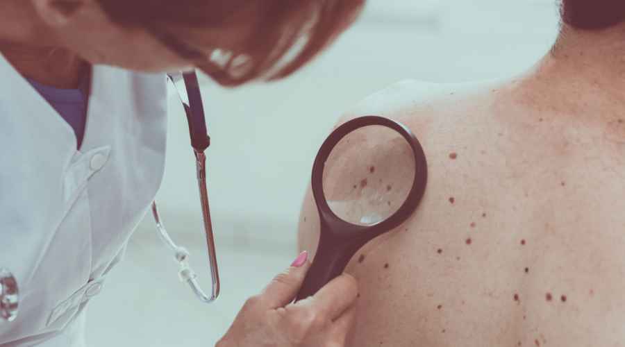 “Salvá tu piel”: Campaña gratuita para prevenir el cáncer de piel llega este fin de semana a Tres Cruces