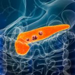 Cáncer de páncreas: claves para entender el hallazgo científico español de una posible cura