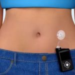 FNR incorporó bomba parche de insulina para diabéticos