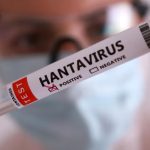 Hantavirus: especialista explicó cómo se transmite y por qué el riesgo de contagio entre personas es bajo