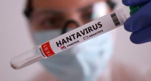 Hantavirus: especialista explicó cómo se transmite y por qué el riesgo de contagio entre personas es bajo