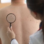 Dermatólogos llaman a la detección temprana para prevenir cáncer de piel en jornadas en el Clínicas