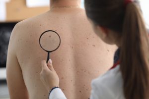 Dermatólogos llaman a la detección temprana para prevenir cáncer de piel en jornadas en el Clínicas